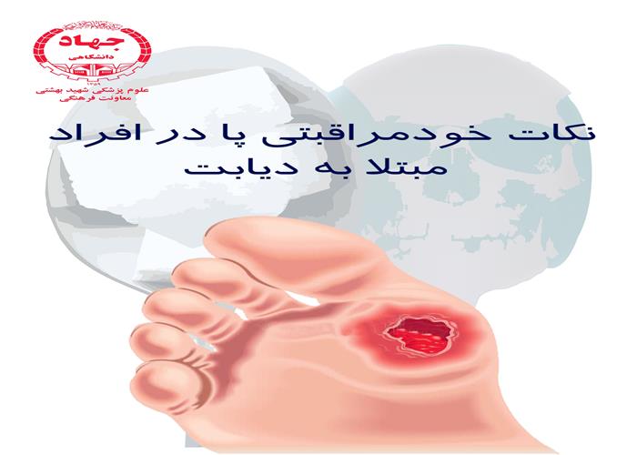 نکات خود مراقبتی پا در افراد مبتلا به دیابت